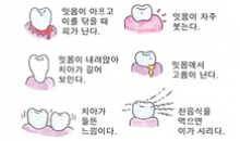 치과의사 유상이의 건강 칼럼(5)