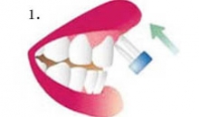 치과의사 유상이의 건강 칼럼(9)
