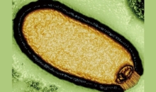 4만8500년간 얼어있던  ‘좀비 바이러스’ 되살아났다