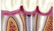 치과의사 유상이의 건강칼럼(4)