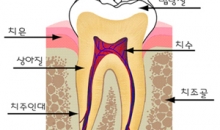 치과의사 유상이의 건강 칼럼(3)